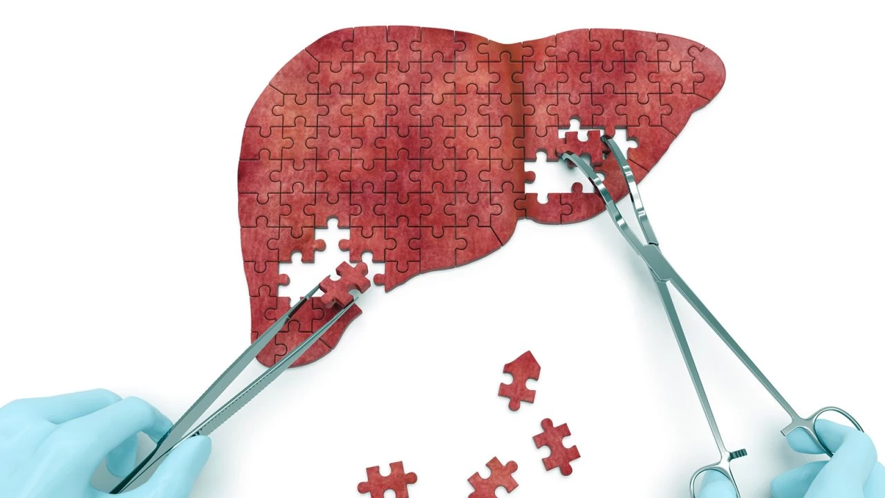 Αλματα προόδου στην αντιμετώπιση του καρκίνου του ήπατος